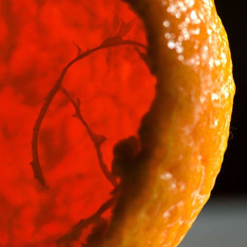 Апельсиновая корка онкология